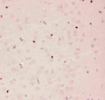 APE1/APEX1 Rabbit Polyclonal Antibody