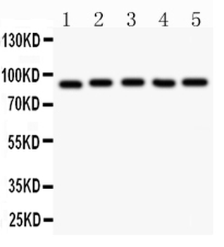 HIF1 beta/ARNT Rabbit Polyclonal Antibody