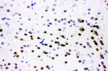 ATF2 Rabbit Polyclonal Antibody