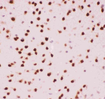 ATF2 Rabbit Polyclonal Antibody