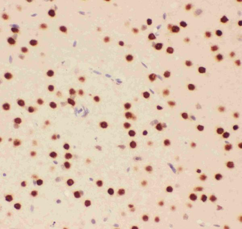 ATF2 Rabbit Polyclonal Antibody
