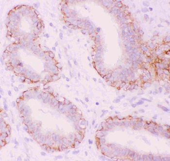 alpha 1 Catenin/CTNNA1 Rabbit Polyclonal Antibody