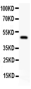 alpha 1 Catenin/CTNNA1 Rabbit Polyclonal Antibody