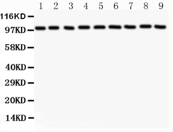 alpha 1 Catenin/CTNNA1 Rabbit Polyclonal Antibody
