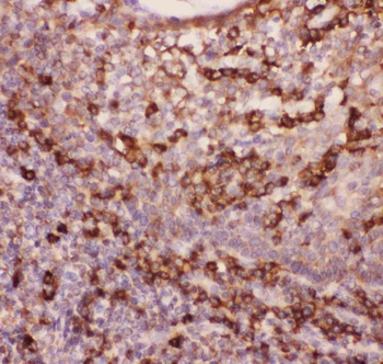 CD11b/ITGAM Rabbit Polyclonal Antibody