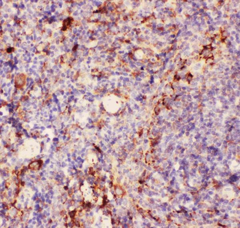CD11b/ITGAM Rabbit Polyclonal Antibody