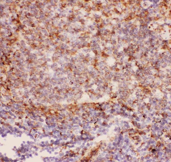 CD11b/ITGAM Rabbit Polyclonal Antibody
