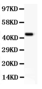CD11b/ITGAM Rabbit Polyclonal Antibody