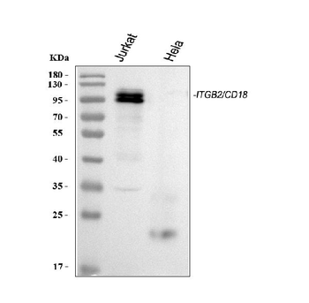 CD18/ITGB2 Rabbit Polyclonal Antibody