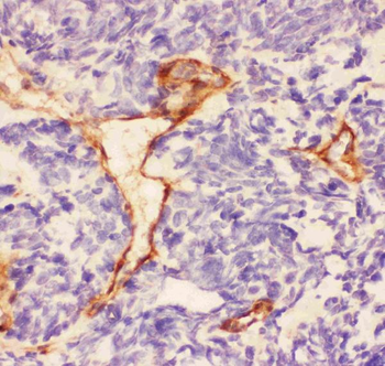 Laminin/Lamc1/Lamc2/Lamc3 Rabbit Polyclonal Antibody