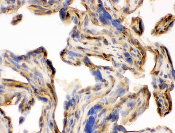 Laminin/Lamc1/Lamc2/Lamc3 Rabbit Polyclonal Antibody