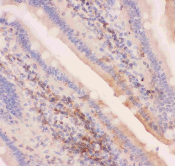 MRP4/ABCC4 Rabbit Polyclonal Antibody