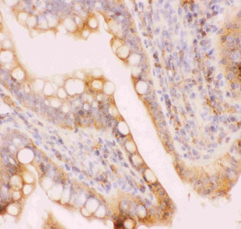 MRP4/ABCC4 Rabbit Polyclonal Antibody
