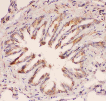 MyD88 Rabbit Polyclonal Antibody