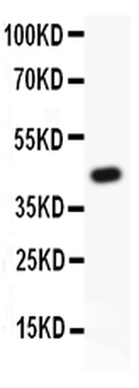 MyD88 Rabbit Polyclonal Antibody