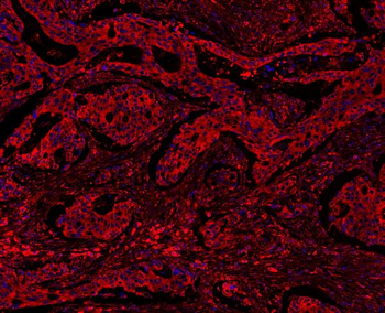 MyD88 Rabbit Polyclonal Antibody