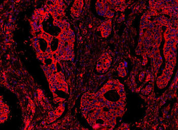MyD88 Rabbit Polyclonal Antibody
