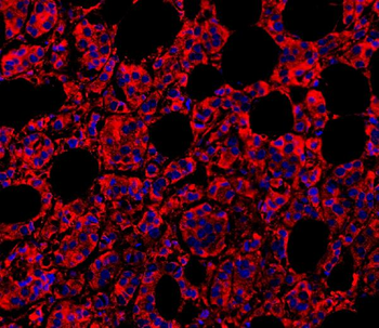 MyD88 Rabbit Polyclonal Antibody