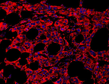 MyD88 Rabbit Polyclonal Antibody