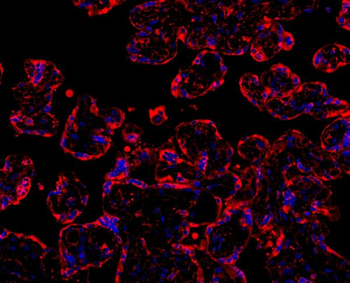 MyD88 Rabbit Polyclonal Antibody
