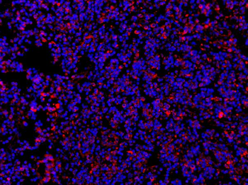 MyD88 Rabbit Polyclonal Antibody