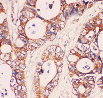 MyD88 Rabbit Polyclonal Antibody