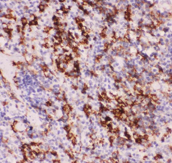 MyD88 Rabbit Polyclonal Antibody