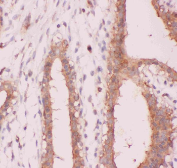 NFkB/NFKB2 p100/p52 Rabbit Polyclonal Antibody