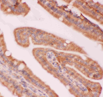 NFkB/NFKB2 p100/p52 Rabbit Polyclonal Antibody
