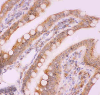 NFkB/NFKB2 p100/p52 Rabbit Polyclonal Antibody