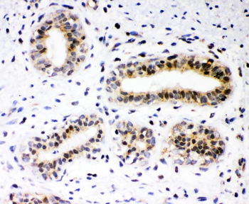 RUNX1/AML1 Rabbit Polyclonal Antibody
