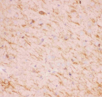 SIRT2 Rabbit Polyclonal Antibody
