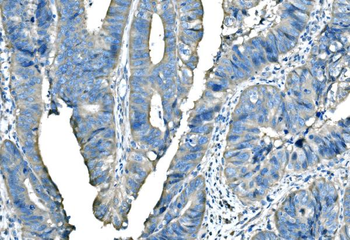 B Raf/BRAF Rabbit Polyclonal Antibody