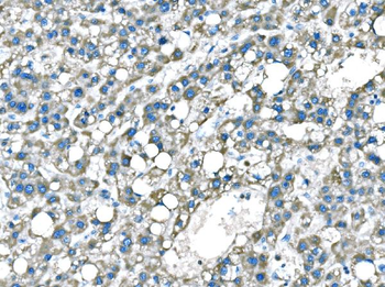 B Raf/BRAF Rabbit Polyclonal Antibody