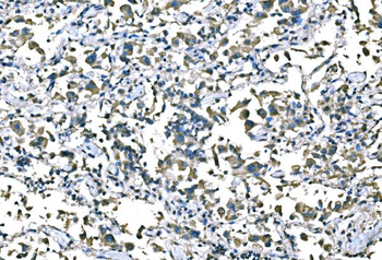 B Raf/BRAF Rabbit Polyclonal Antibody