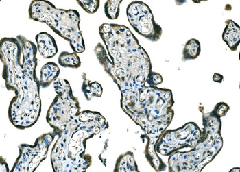 B Raf/BRAF Rabbit Polyclonal Antibody