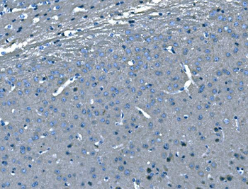 B Raf/BRAF Rabbit Polyclonal Antibody