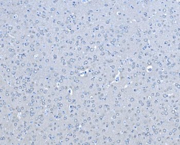 B Raf/BRAF Rabbit Polyclonal Antibody