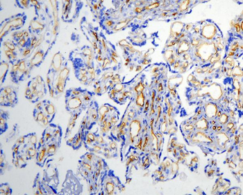 Caveolin-1/CAV1 Rabbit Polyclonal Antibody