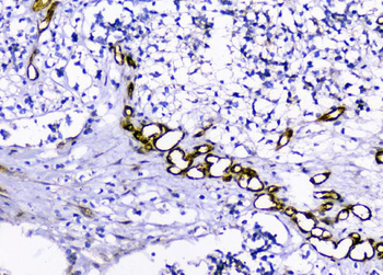 Caveolin-1/CAV1 Rabbit Polyclonal Antibody