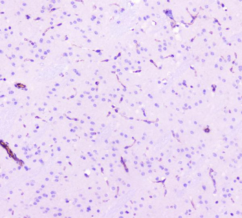 Caveolin-1/CAV1 Rabbit Polyclonal Antibody