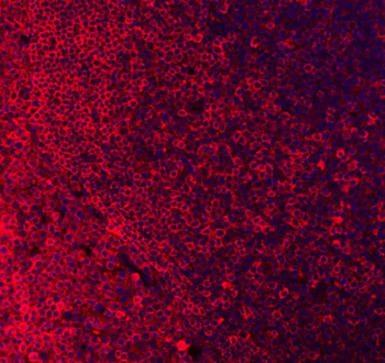 CD79a Rabbit Polyclonal Antibody