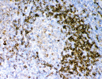 CD79a Rabbit Polyclonal Antibody
