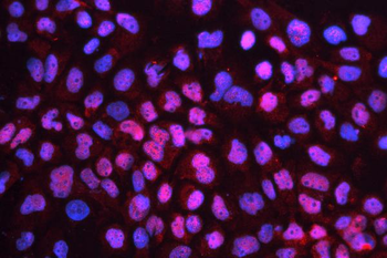 CD79b Rabbit Polyclonal Antibody