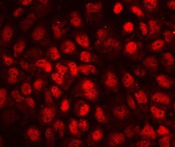 CD79b Rabbit Polyclonal Antibody