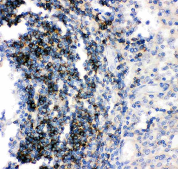 CD79b Rabbit Polyclonal Antibody