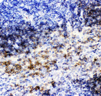 CD79b Rabbit Polyclonal Antibody