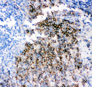 CD79b Rabbit Polyclonal Antibody