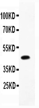 CD79b Rabbit Polyclonal Antibody
