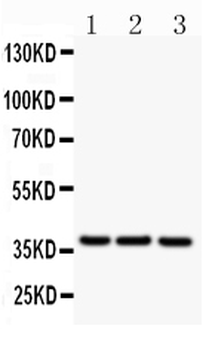 CD79b Rabbit Polyclonal Antibody